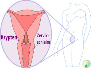 Zervixschleim Gebärmutterhals