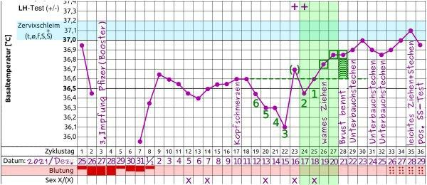 Zervixschleim vor Periode Erfahrungen in einem Zyklus einer Eileiterschwangerschaft