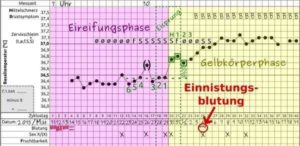 Ausfluss Nach Befruchtung - Wie Sieht Er Aus?